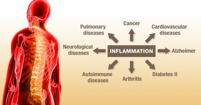 resveratrol and inflammation